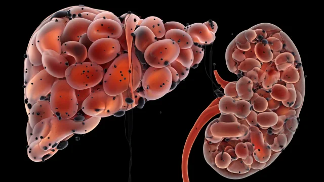 alibarbar 購入ガイド