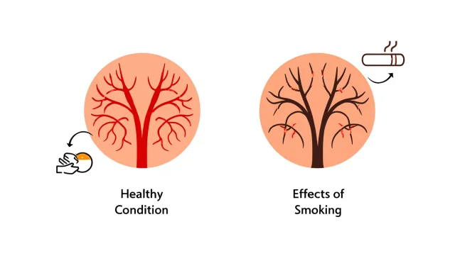 アイコス 副流煙 妊婦 - 専門家ガイドとレビュー
